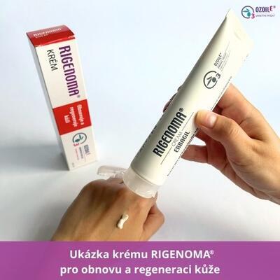 2x RIGENOMA krém pro obnovu a regeneraci kůže s OZOILE 100 ml - 3