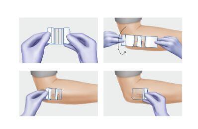 Náplast fixační HYDROFILM - 3